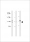 EPC1 Antibody (Center)